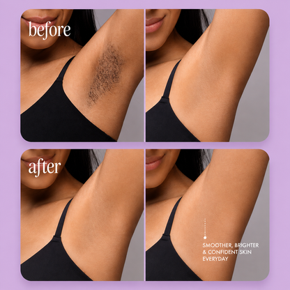 AUNA™ 2-IN-1 Trimmer & Shaver